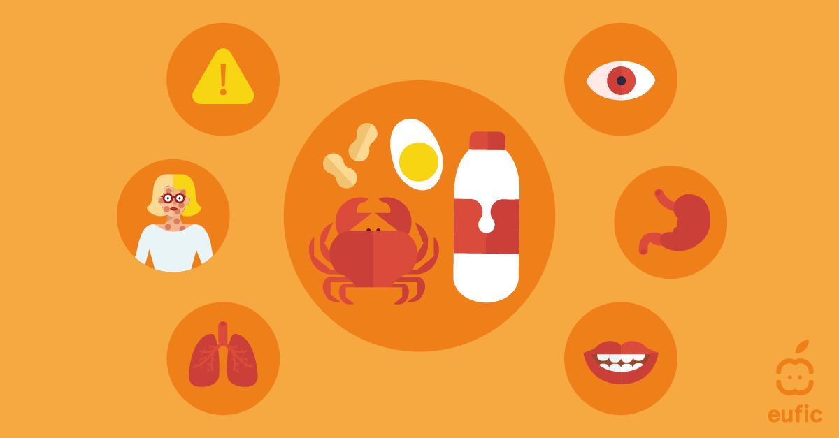 FoodAllergens update 2025 SM