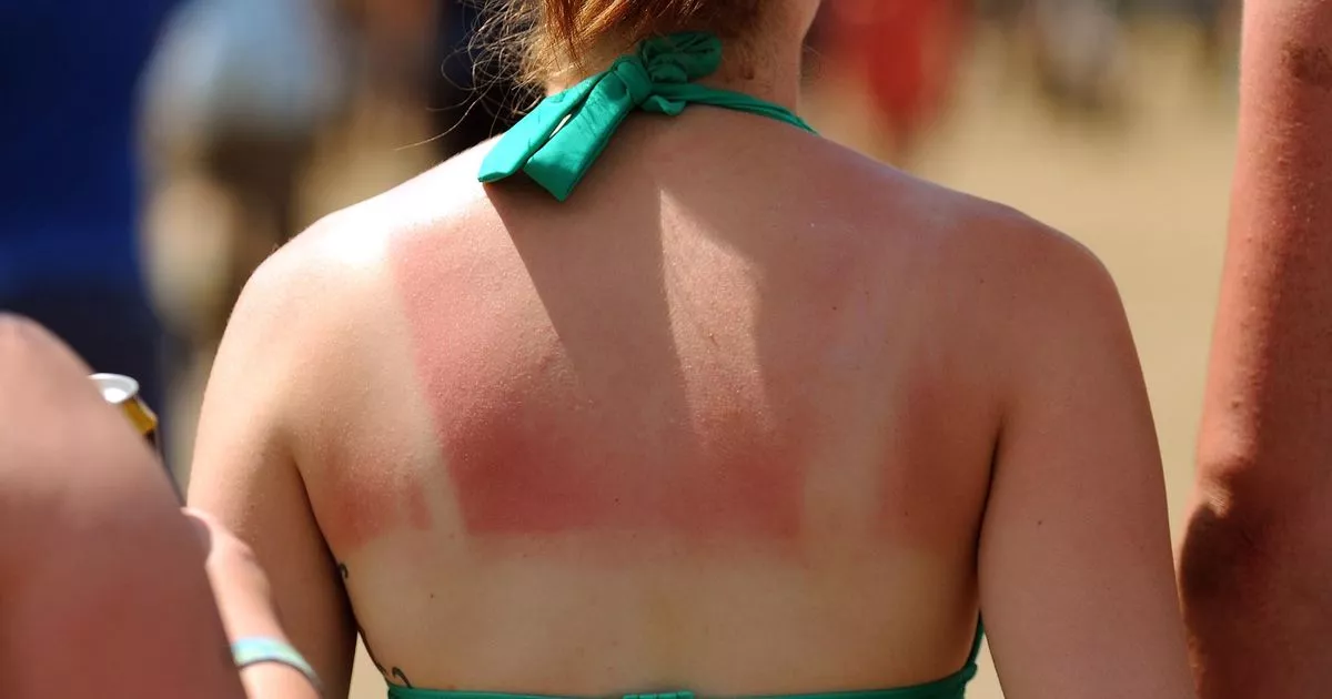 0 MPs issue call over tanning salons