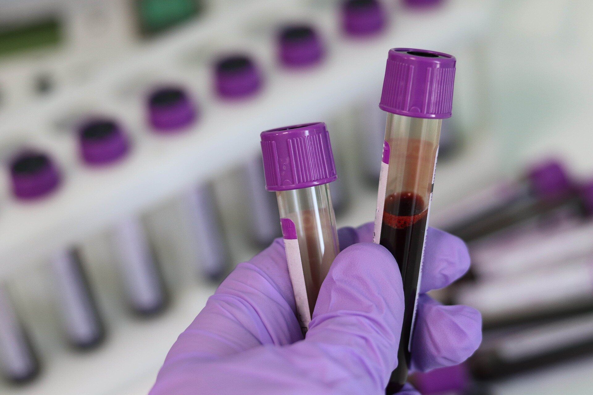 2 bloodtest