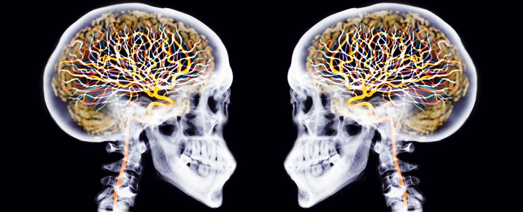 TwoSkullsWithBrainsAndNeurons
