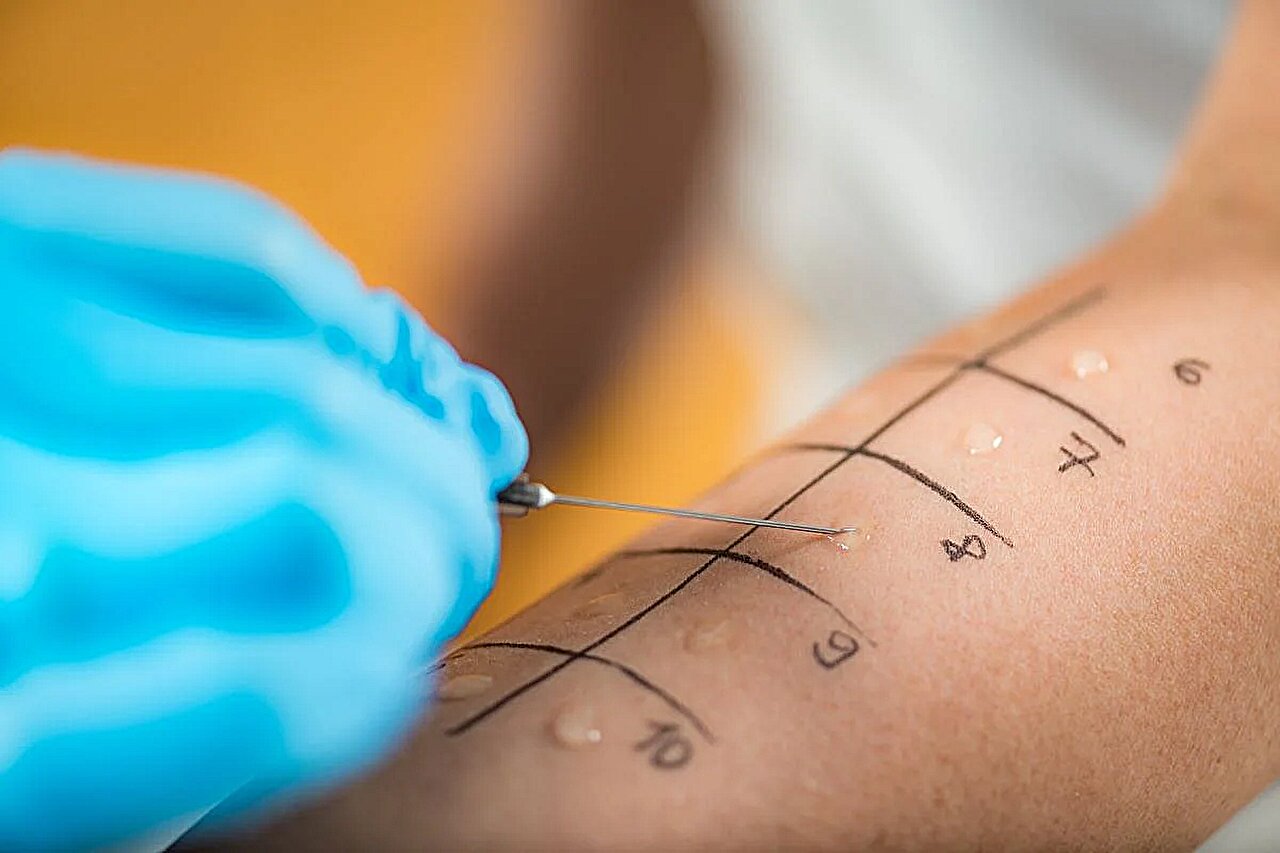 skin prick automated t