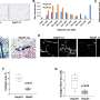 study identifies new t