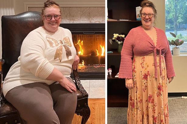 1 Simple before and after weight loss