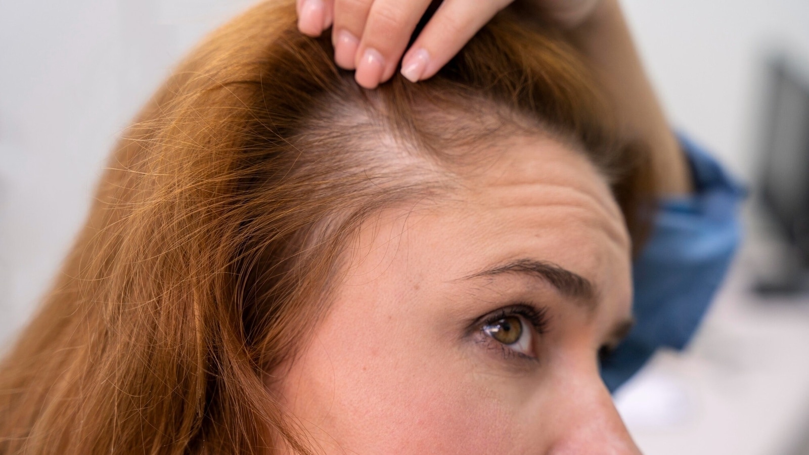hair loss 1754108904038 1754108904237