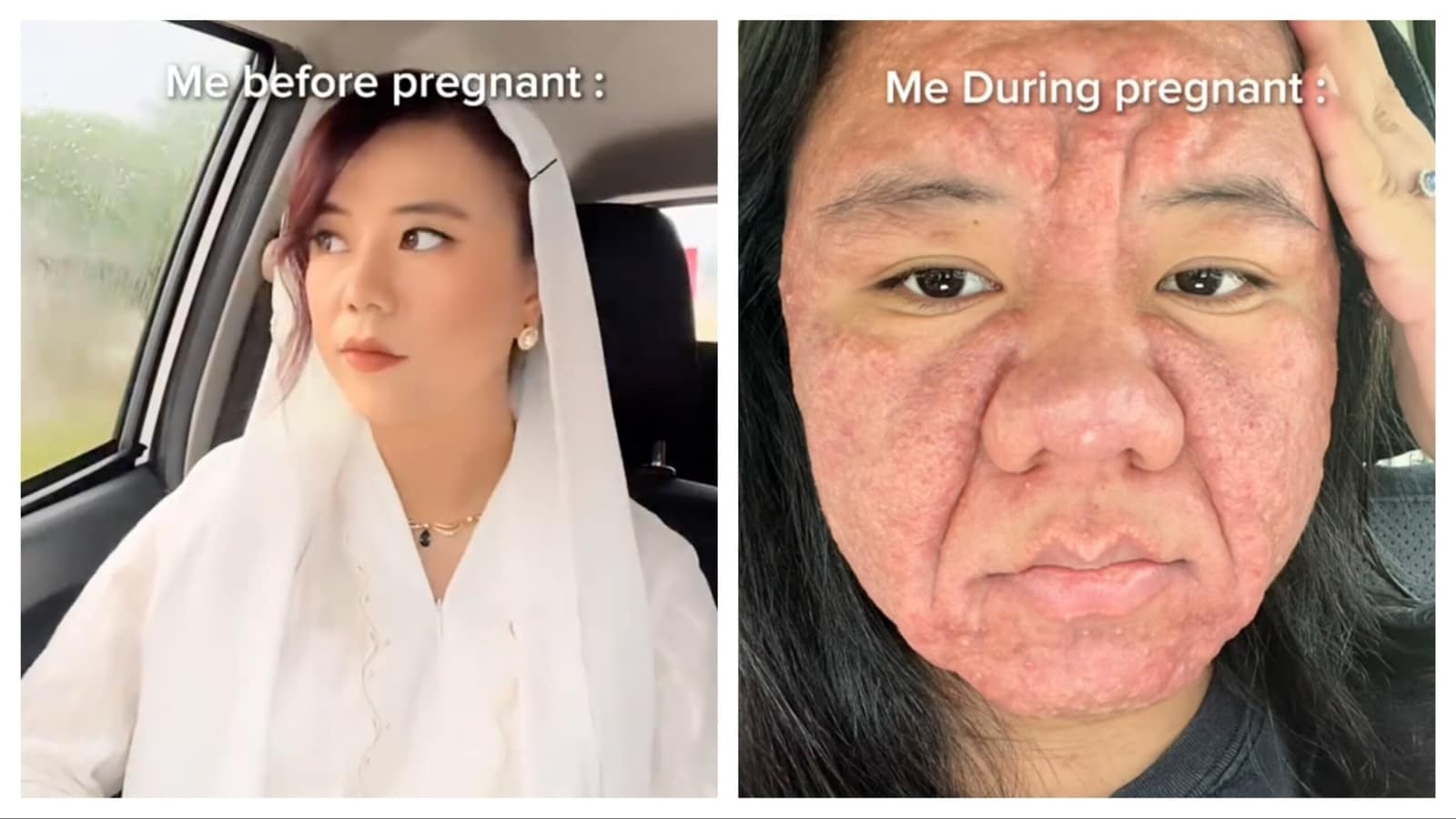 pregnant skin 1754220015096 1754220023445