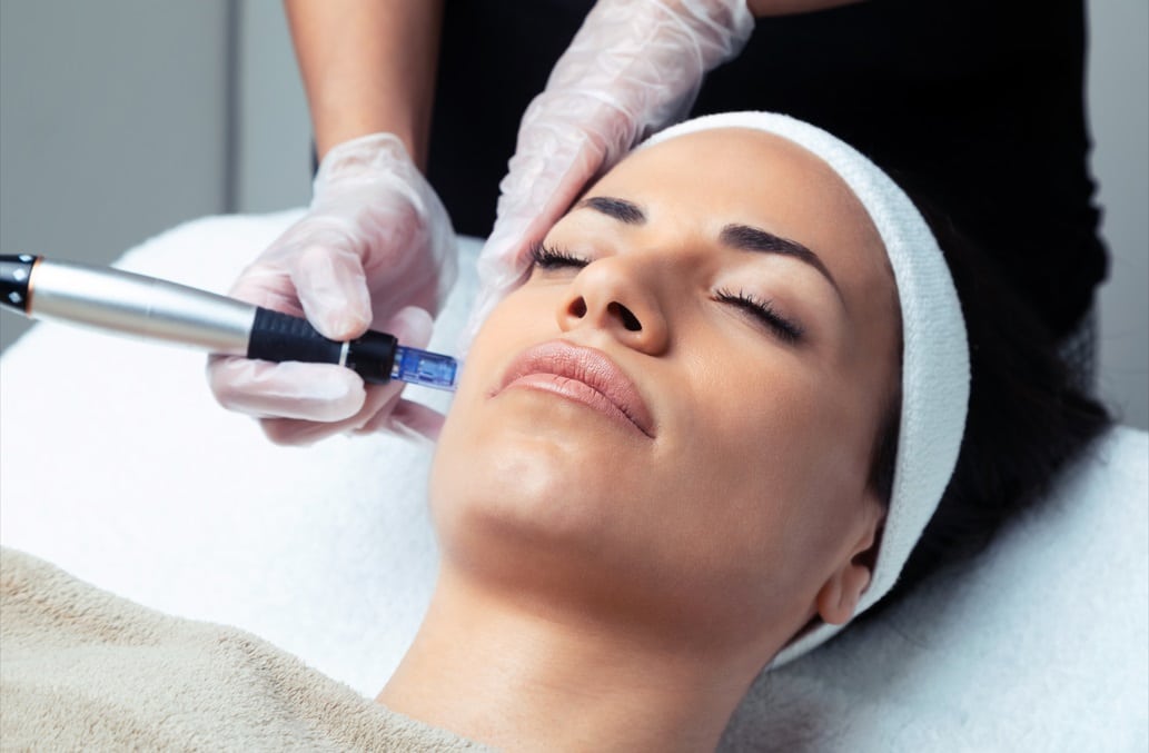 woman receiving microneedling with exosomes cosmetic dermatology treatment