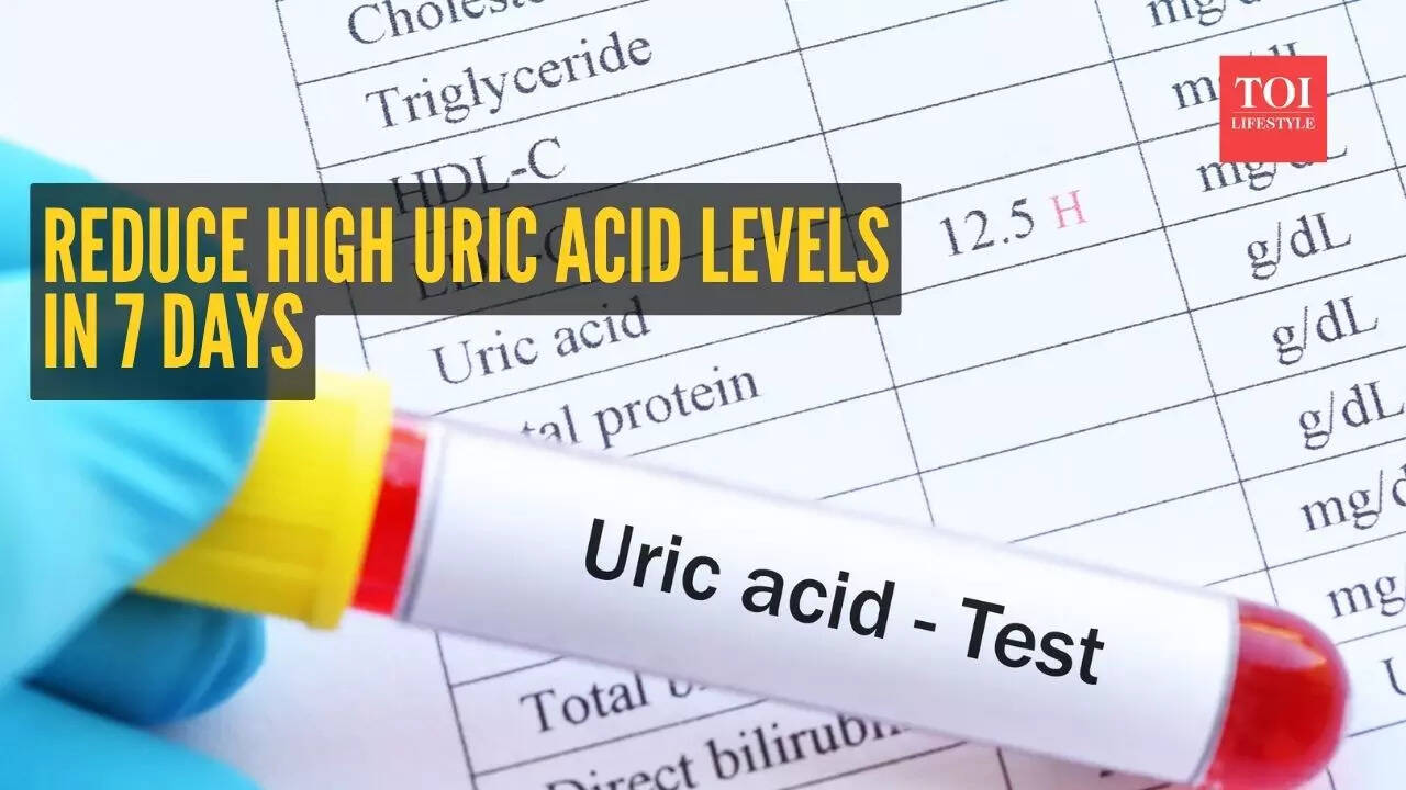 How to reduce high uric acid levels naturally: Metabolic doctor shares 11 tips in 7 days - The Times of India 3 124995482