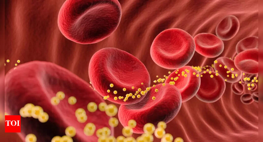 What are triglycerides: All about their impact, and how to bring them down 2 photo 25
