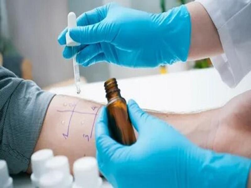 Allergy Diagnostics Market to Reach US$ 11.63 Bn by 2030 at 10.4% CAGR | Key Players: Danaher, BioMerieux, Thermo Fisher, Siemens, HOB Biotech 5 Lc05225271 g