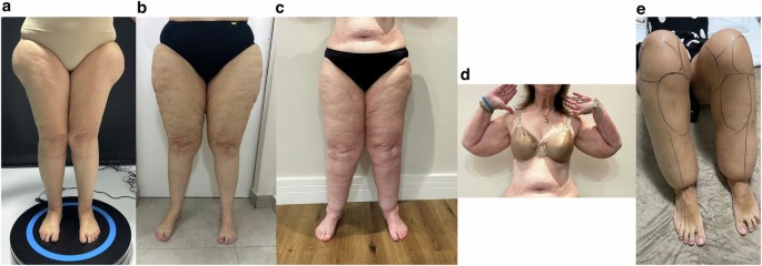 44324 2025 93 Fig1 HTML