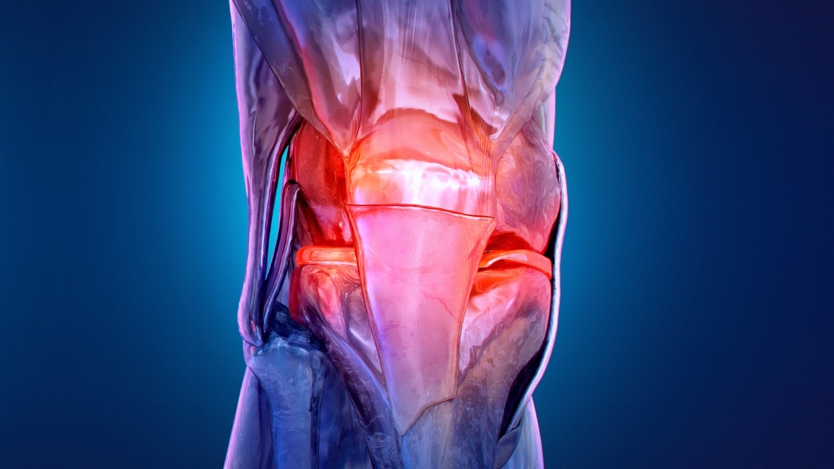 red inflamed knee illo header