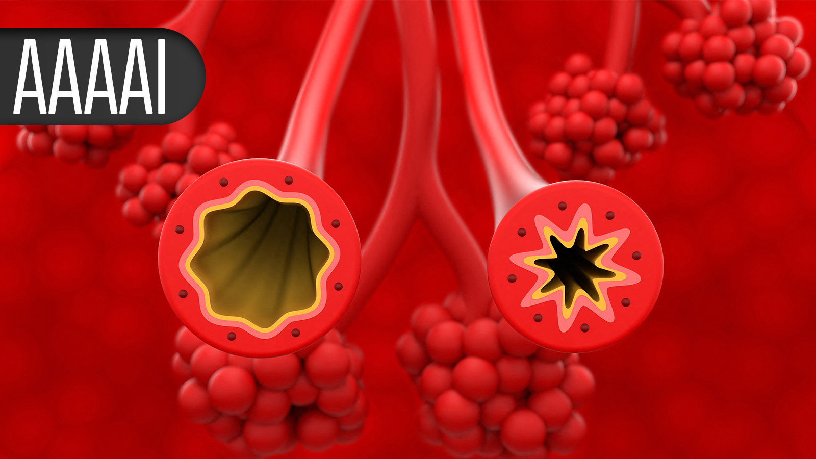 Vitamin D for Babies No Help in Preventing Food Allergy 2 120130
