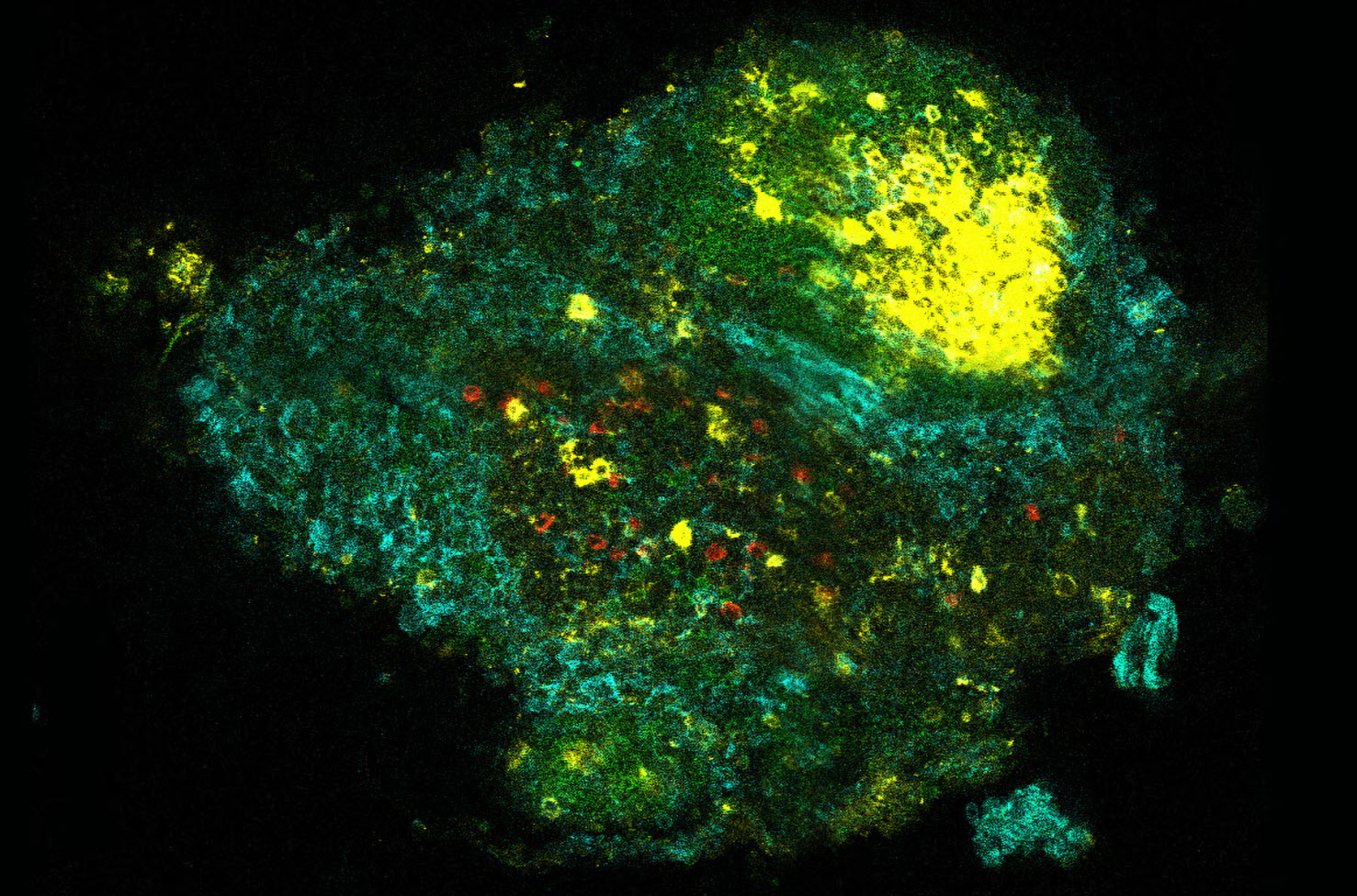 How the environment can shape future allergies - National Institutes of Health (.gov) 3 20260303 allergy