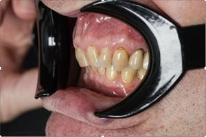 If you are a mouth breather, read this 1 69a5dc33e4b3a.image