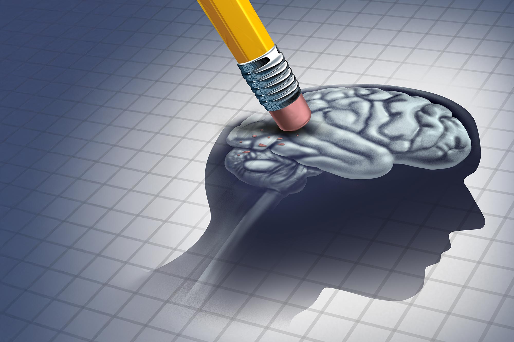 Erasing Brain Alzheimers Dementia Wide