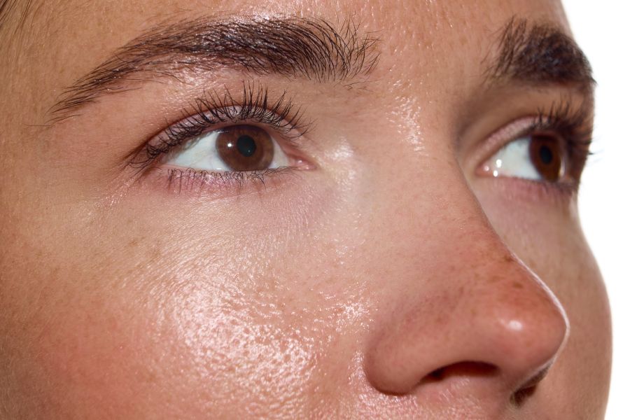 639123606911332023Skin B slider