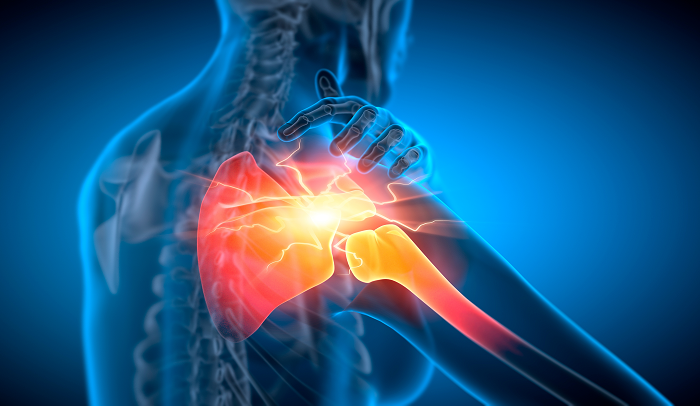 Bupa MSK mental health Sept24