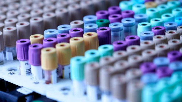 blood test tubes rack unsplash 640x360 1