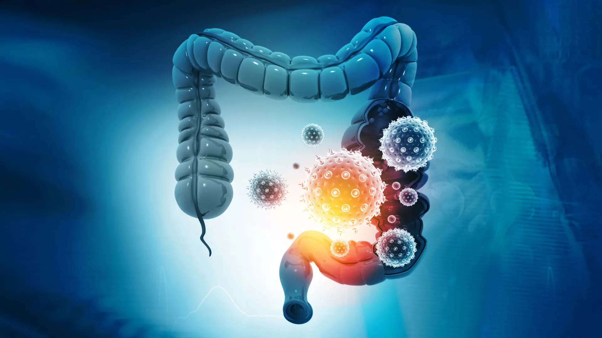 colon cancer bacteria viruses