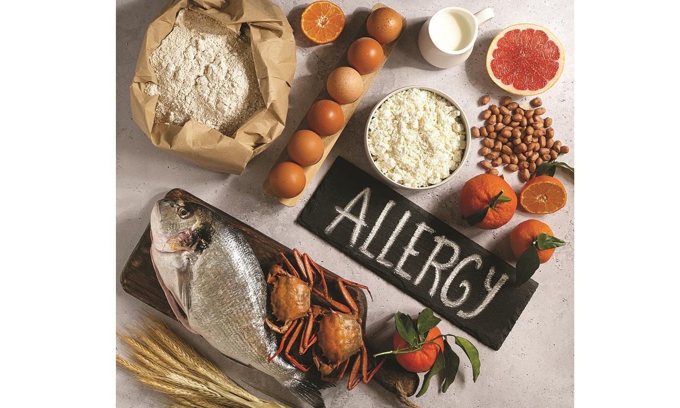 2036858 view allergens commonly found food