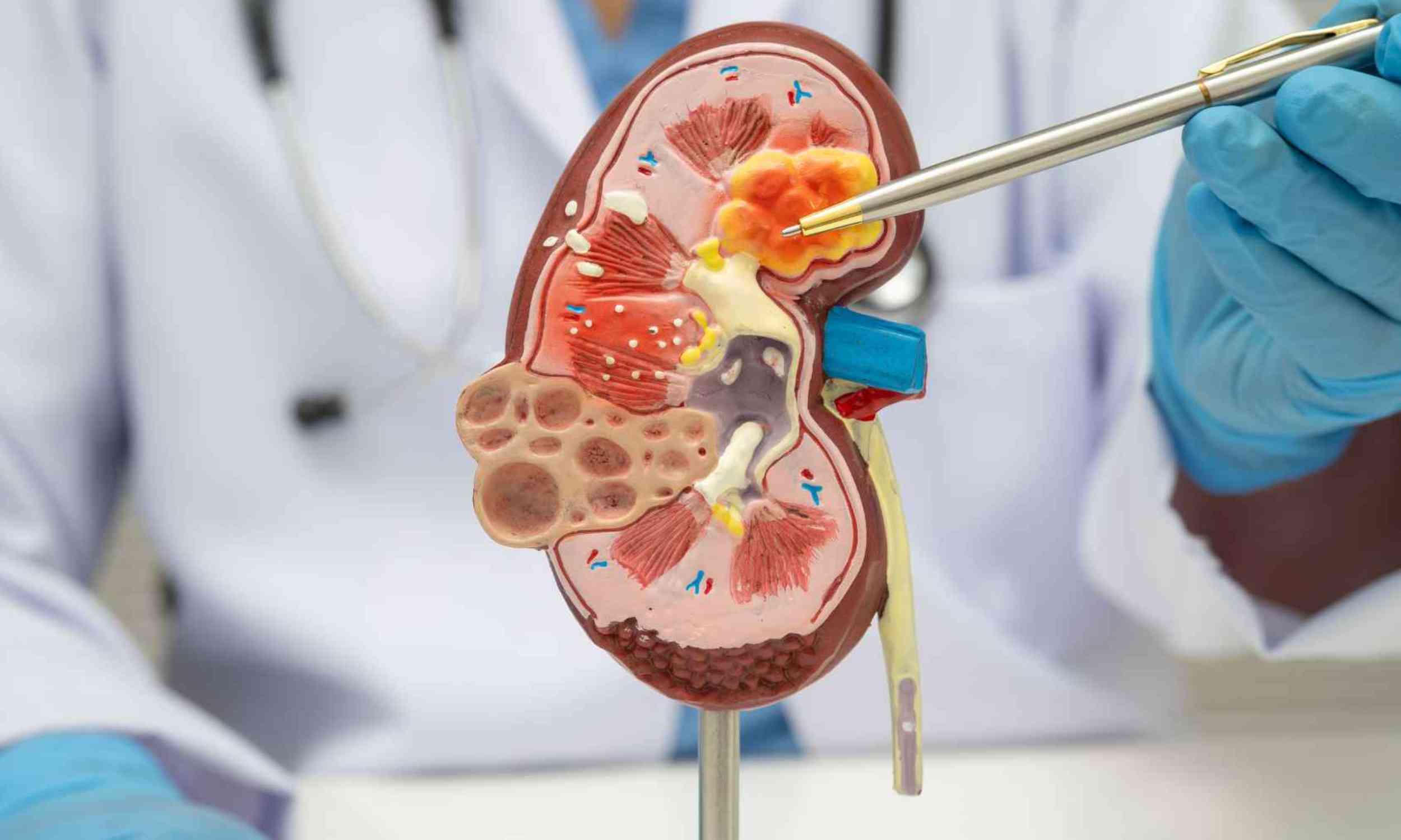 crohns disease diet gut inflammation trial