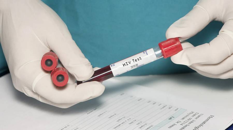hiv cases rise sharply kp 481 new infections reported four months 1777736161 2569