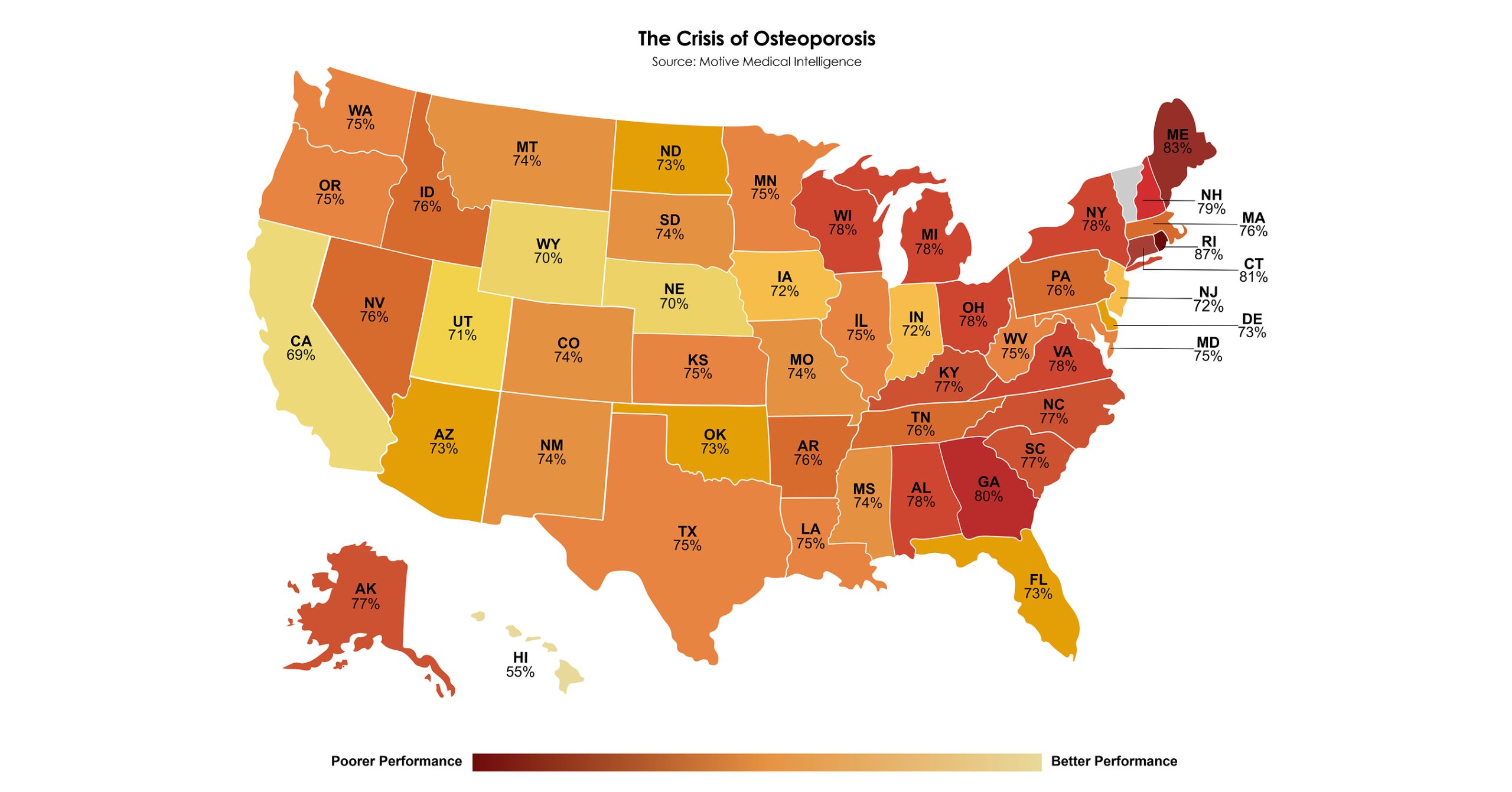 Motive Medical Intelligence osteoporosis scaled