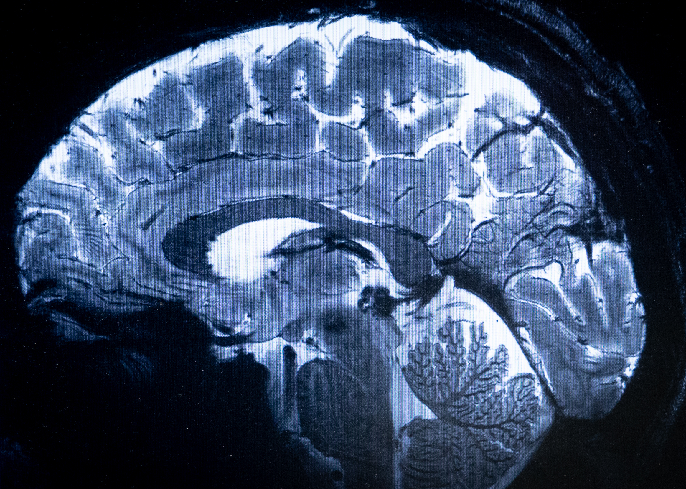 brain