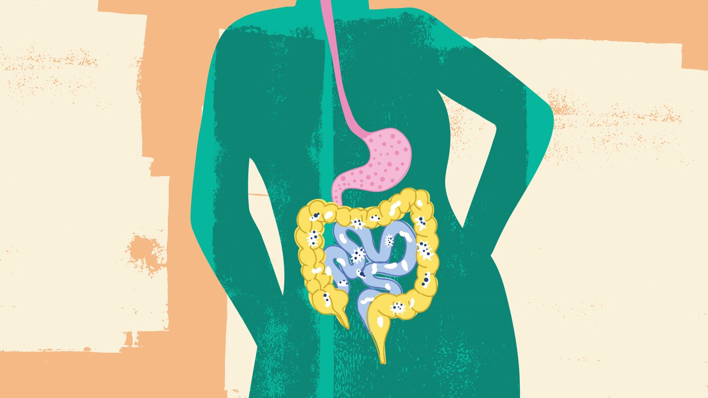 8 things to know about the gut microbiome and keeping yours healthy - NPR 1 unnamed file.jpeg 2
